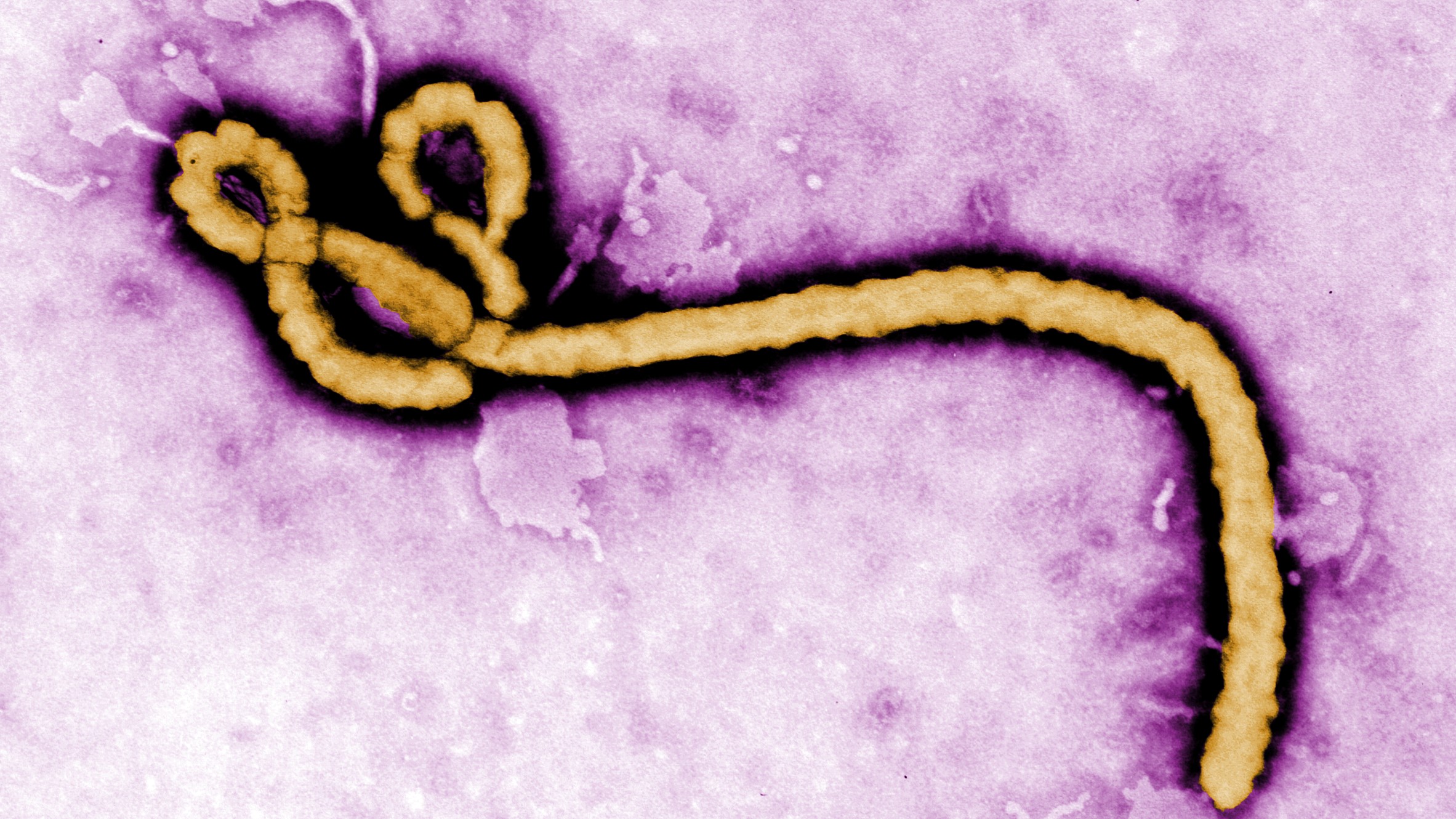 Ebola Outbreak in Congo and Uganda Declared Global Health Emergency