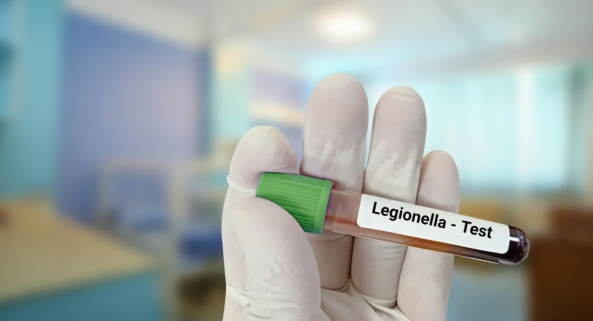 Legionnaires' Disease Outbreak Spreads Across New York City; 60 People Sickened