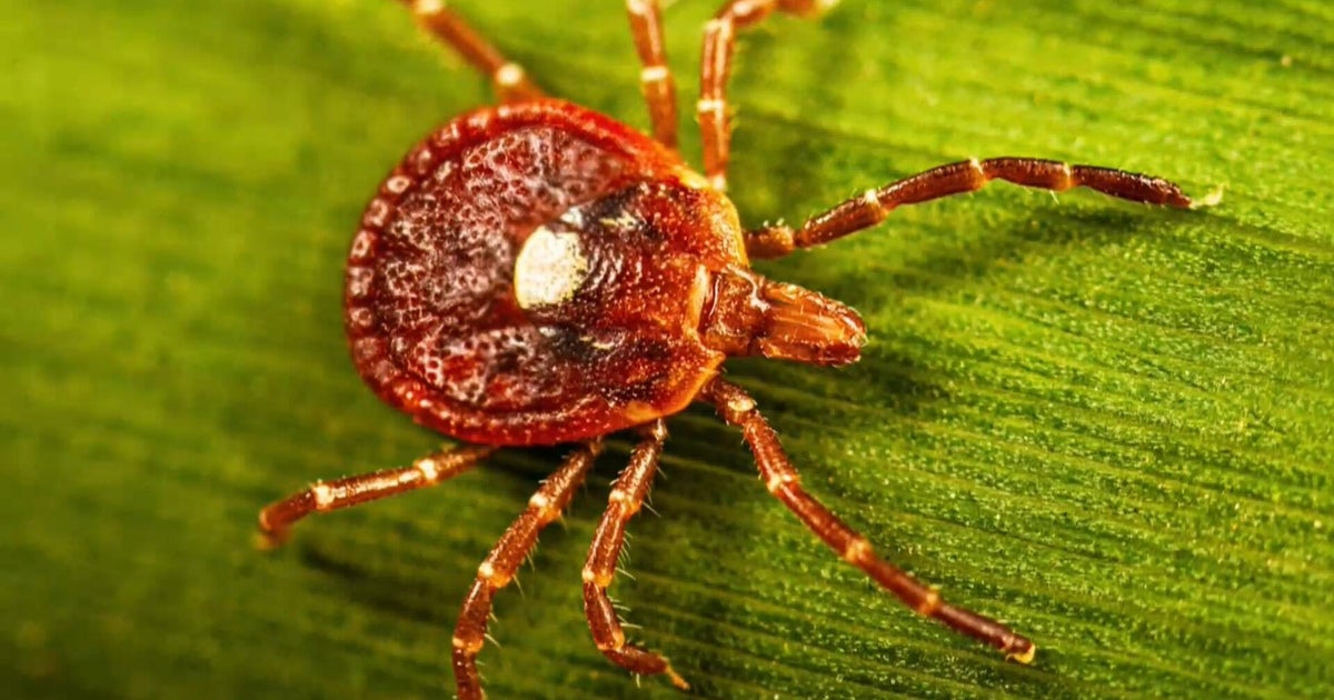 Tick Season Surges With Record Emergency Room Visits Across Much of the U.S.